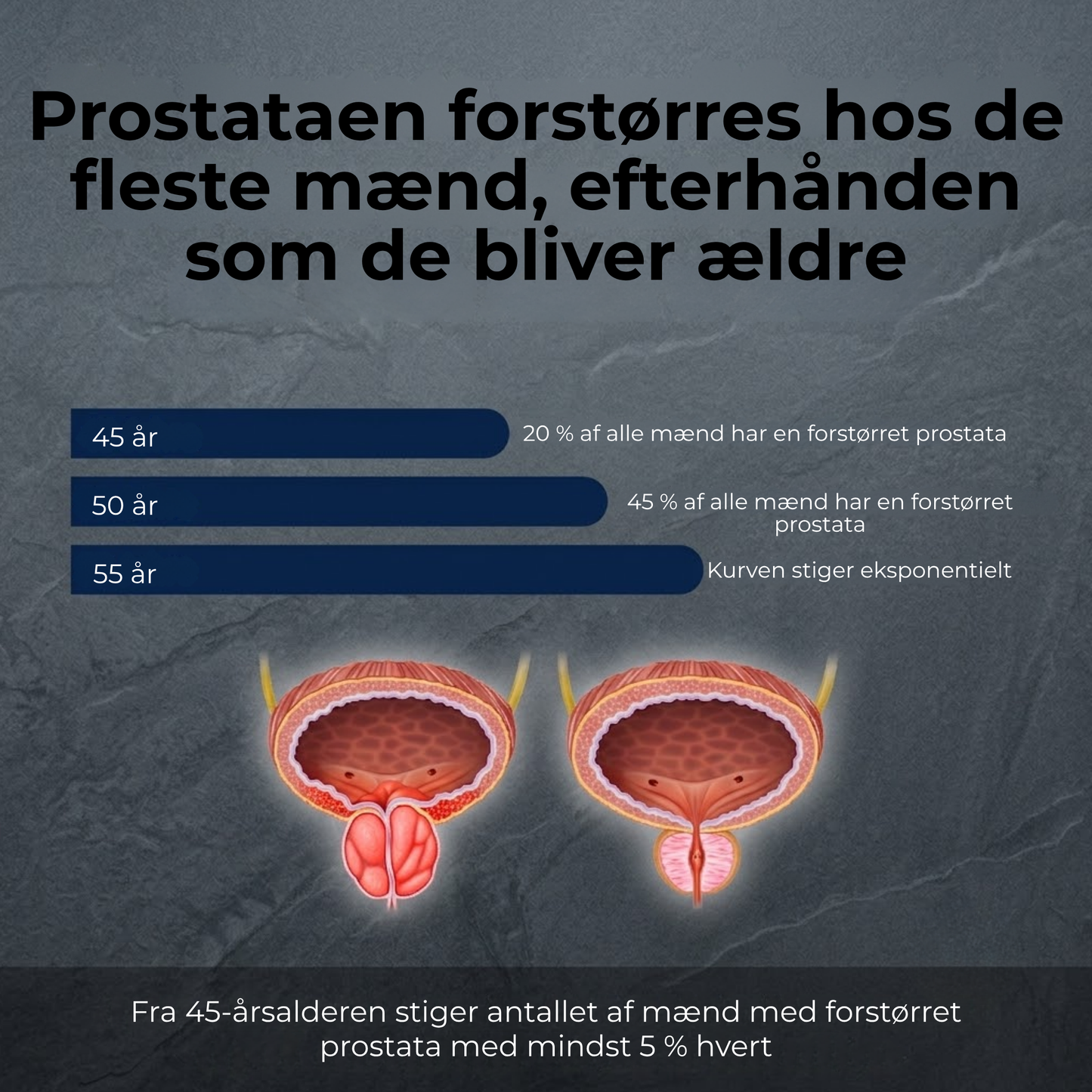 Prostanova | Få Mere Ro i Hverdagen med Naturlig Prostatastøtte