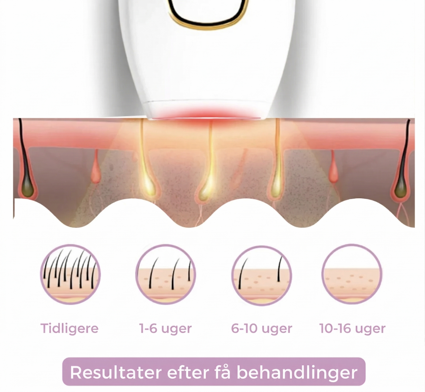 Silke™ IPL Hårfjerner. Få silkeblød hud hver dag
